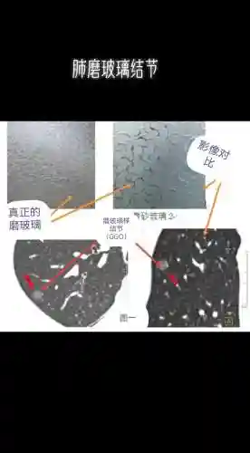 ct阵容英文插图1
